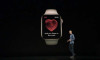 Apple Watch'un EKG uygulaması başka bir hayat daha kurtardı