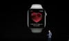 Apple Watch kalp ritim bozukluğu tespitinde başarısını kanıtladı