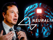 Elon Musk beyin çipi deneylerine başlıyor!