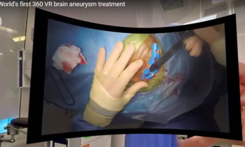Dünyanın ilk VR beyin ameliyatı