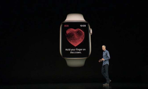 Apple Watch'un EKG uygulaması başka bir hayat daha kurtardı
