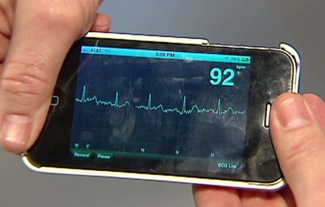 iPhone kalp krizini önceden uyaracak